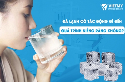 Niềng Răng và Tác Động Của Đá Lạnh: Những Lưu Ý Quan Trọng Cho Quá Trình Chỉnh Nha